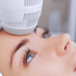 Cryofacial