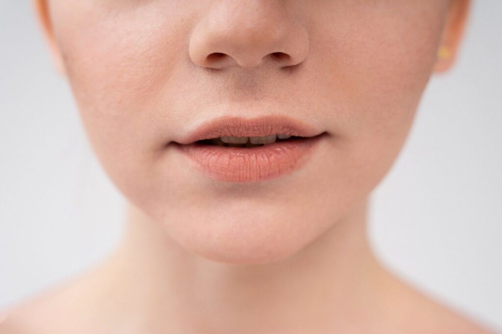 hollow cheeks