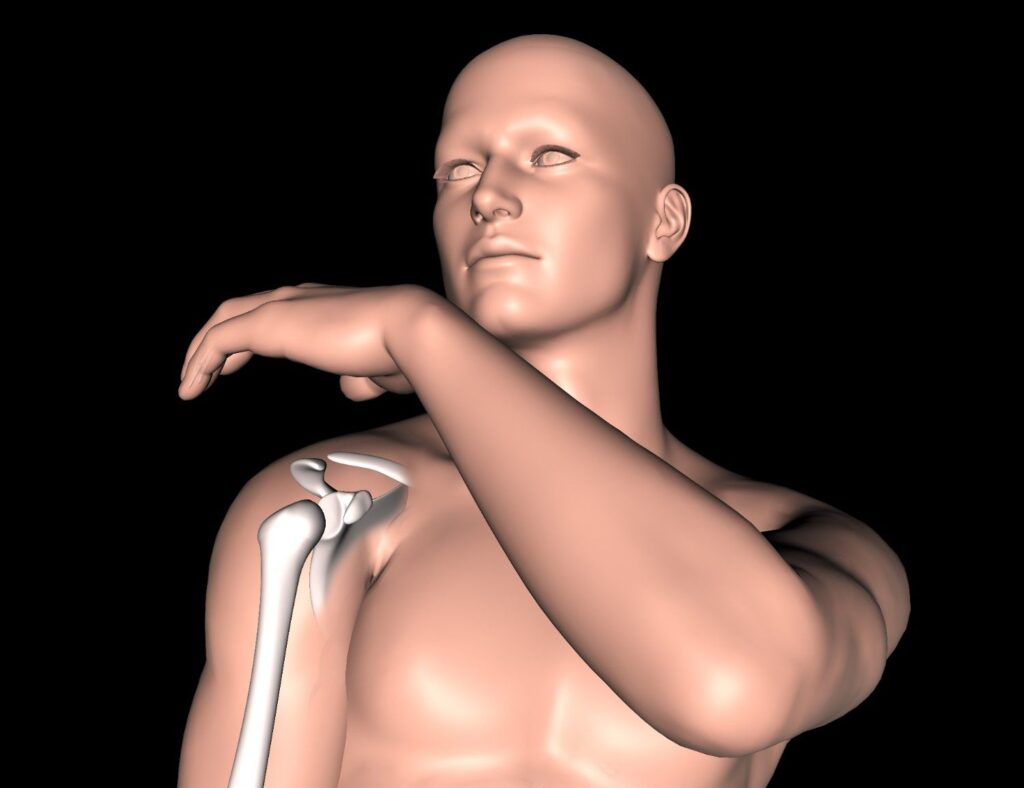 bone spurs in shoulder